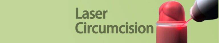 laser circumcision indore, circumcision in indore
