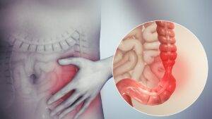 proctologist-in-indore, piles doctor in indore