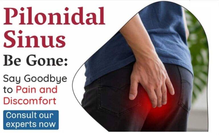 pilonidal surgeon in indore, best doctor for pilonidal sinus in indore