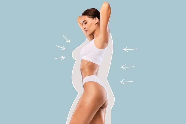 liposuction treatment indore, लिपोसक्शन इंदौर