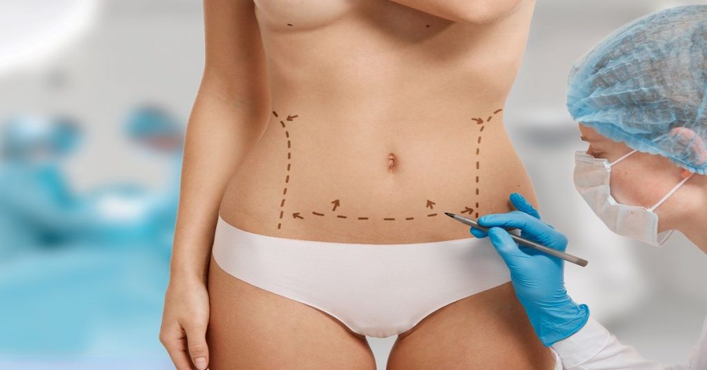 best liposuction surgery in indore,liposuction in indore, liposuction surgery in indore,