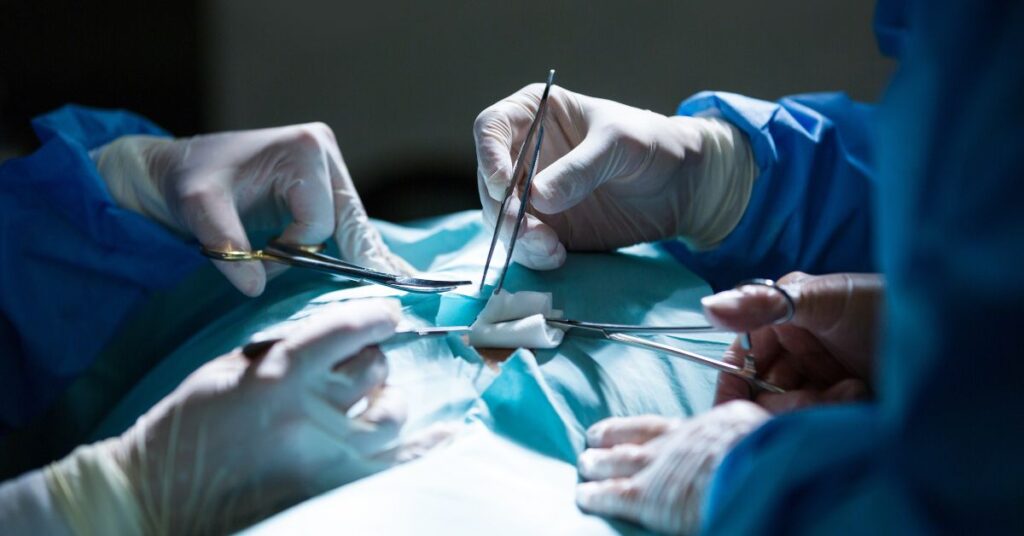 fissure surgery in indore