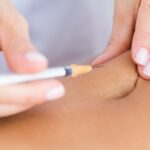 best liposuction surgeon in indore
