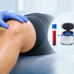 prp treatment indore
